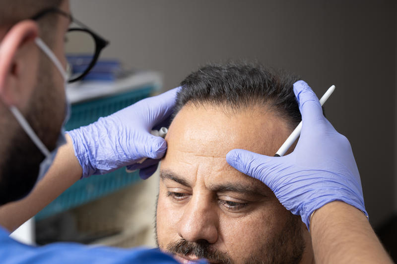 Bald ambition / The vanity of hair transplants