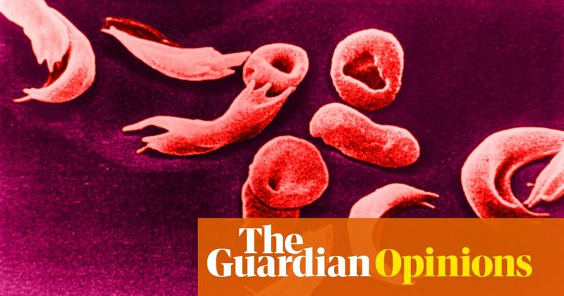 This new sickle cell treatment could be a gamechanger – if the NHS really starts to care about black people’s health