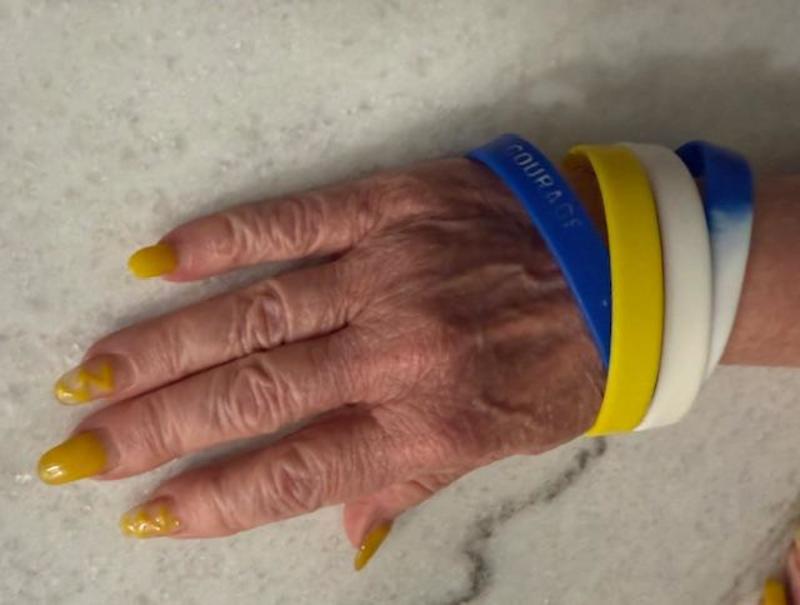 Hadassah’s Yellow Nail Initiative