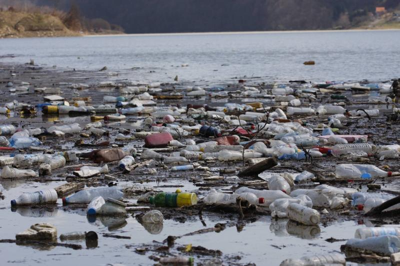 You might have plastic in your brain. Don’t panic — yet.